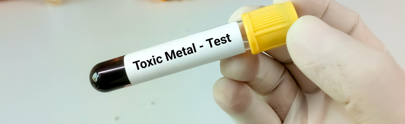 Years of Lead Exposure Damages the Aging Brain