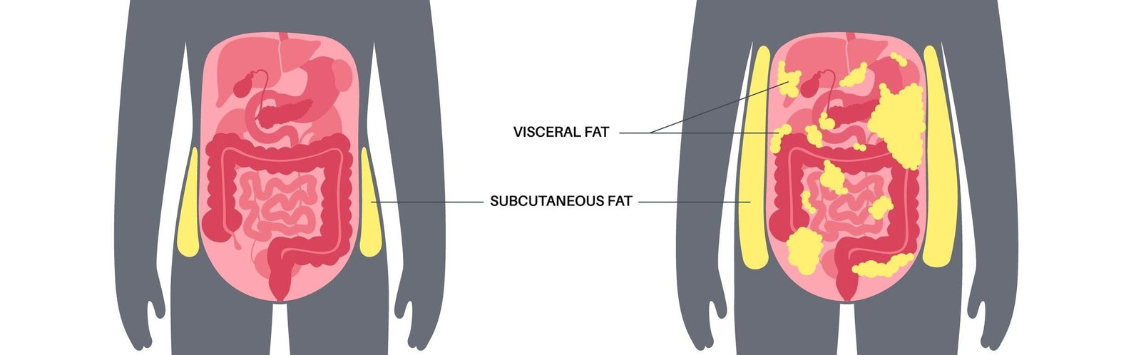 Hidden Body Fat Accelerates Heart Ageing