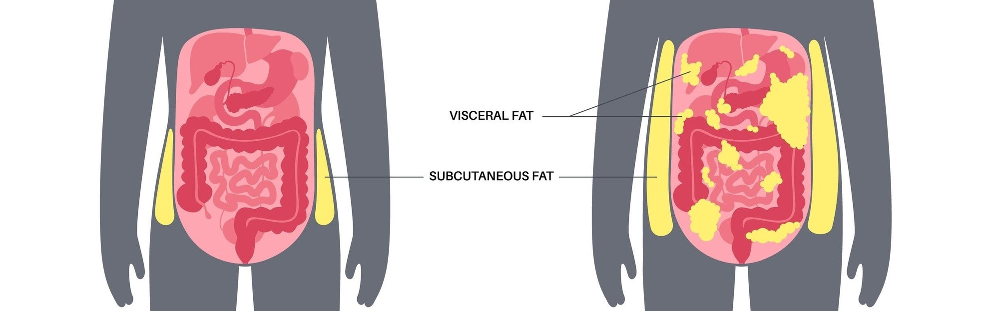 Hidden Body Fat Accelerates Heart Ageing