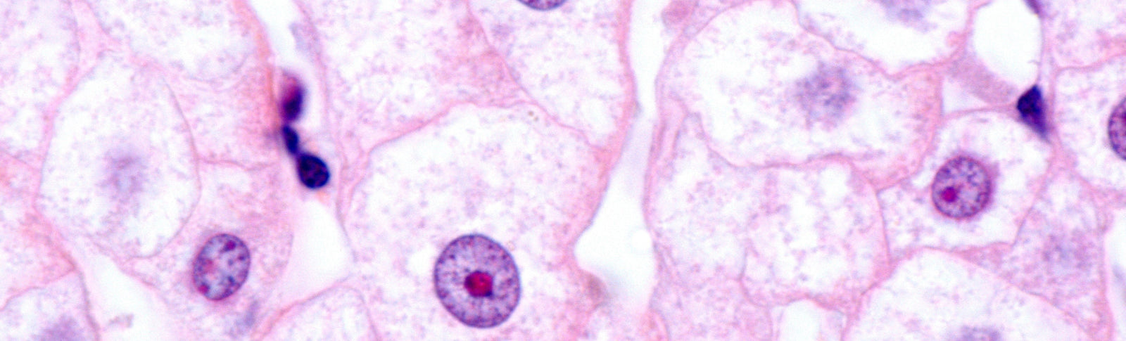 New Cell May Replace Liver Transplants