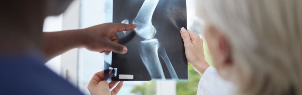 Unhealthy Microbiome May Affect Bone Health